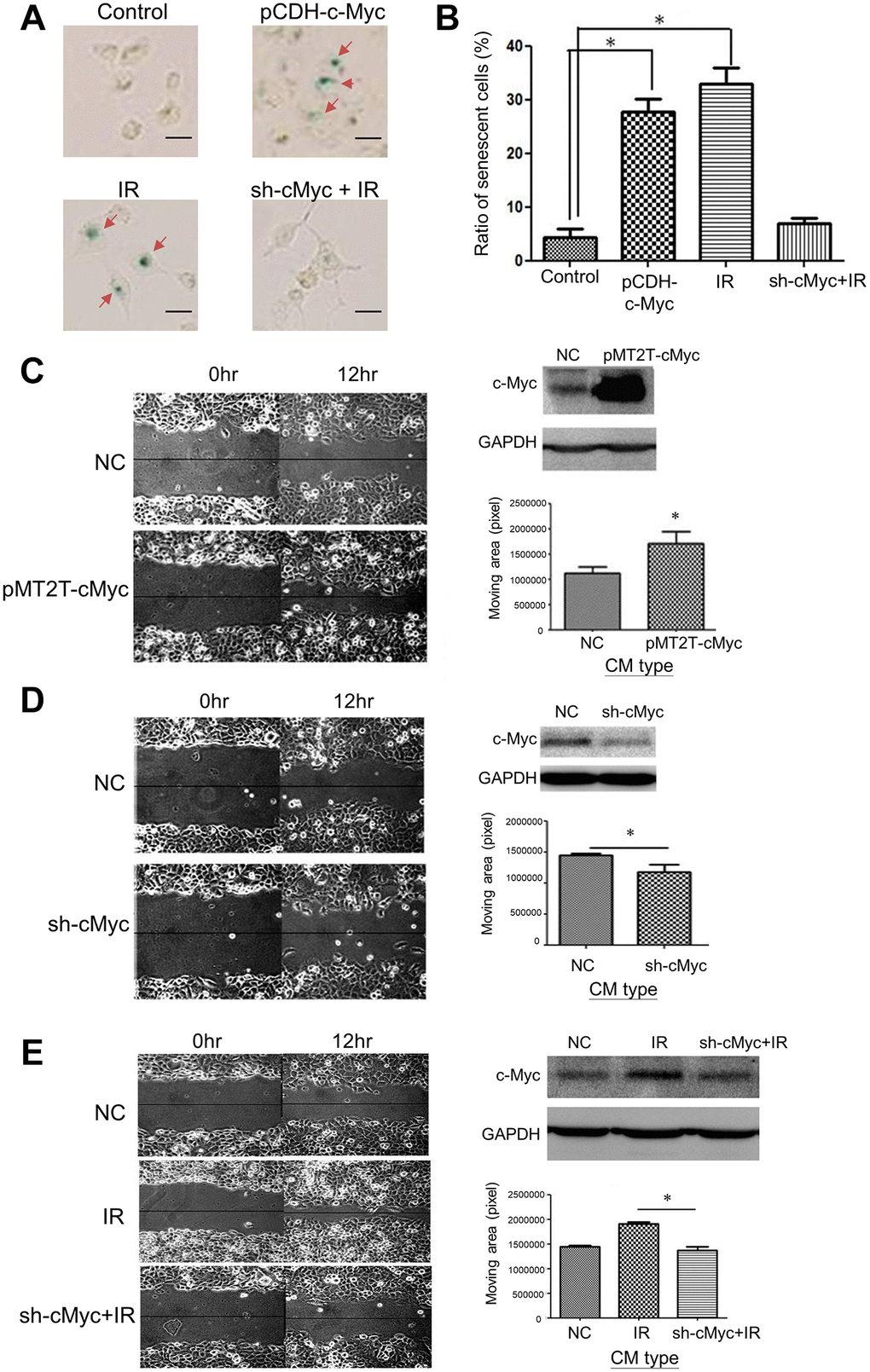 Effects of c-Myc expression on LDR induced senescence and unirradiated cell migration. (A) The level of SA-β-gal staining was increased by over-expression of c-Myc in H1299 cells. Radiation induced SA-β-gal was reduced by knockdown of c-Myc using shRNA. Scale bar: 100 μm. (B) Quantification of cell number stained by X-gal after different treatments. (C) Comparison of cell migration rate between normal medium and CM collected from c-Myc cover-expressing cells. (D) Comparison of cell migration rate between normal medium and CM collected from c-Myc knockdown cells. (E) Enhanced migration of H1299 cells by CM collected from LDR irradiated cells was suppressed by knockdown of c-Myc in irradiated cells. *p 