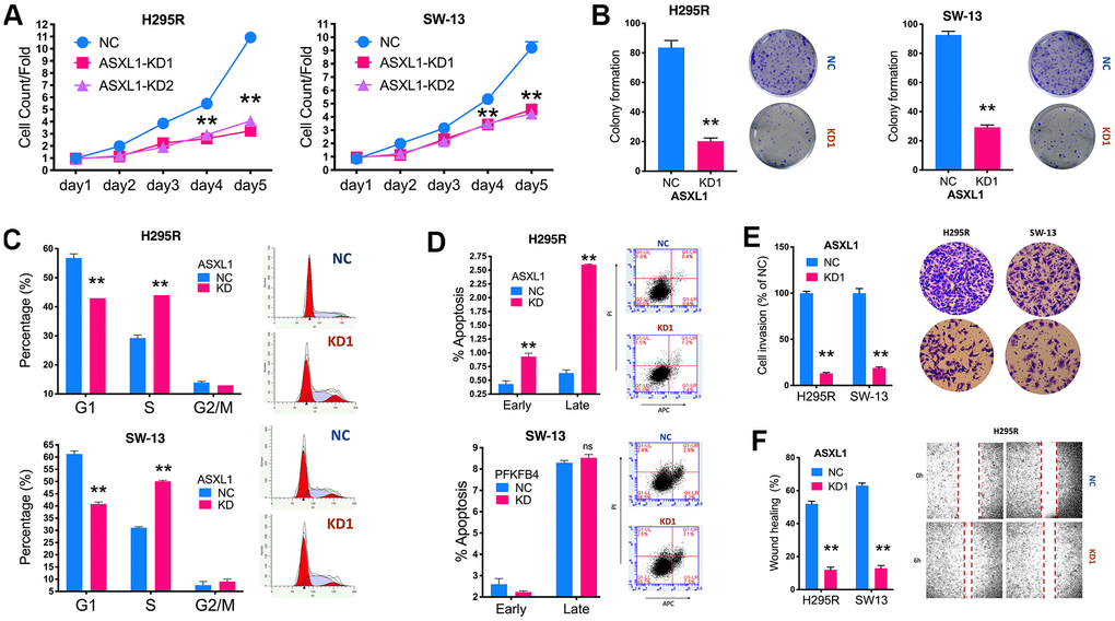 Silencing of ASXL1 decreased fitness of adrenocortical carcinoma (ACC) cells. (A) Cell count detected using CCK-8 in ACC cell lines with ASXL1-knockdown (KD) by shRNA#1 and shRNA#2 (KD1 and KD2) or negative control (NC); (B) Colony formation in ACC cell lines with ASXL1 silencing or control); Flow cytometry used to detect (C) cell cycle profile and (D) apoptosis in ACC cells with ASXL1-KD or NC; (E) Transwell assays used to detect cell invasion with Matrigel in ACC cells with ASXL1-KD or NC, captured at 100×; (F) Wound healing assay in ACC cells with ASXL1-KD or NC (**P 