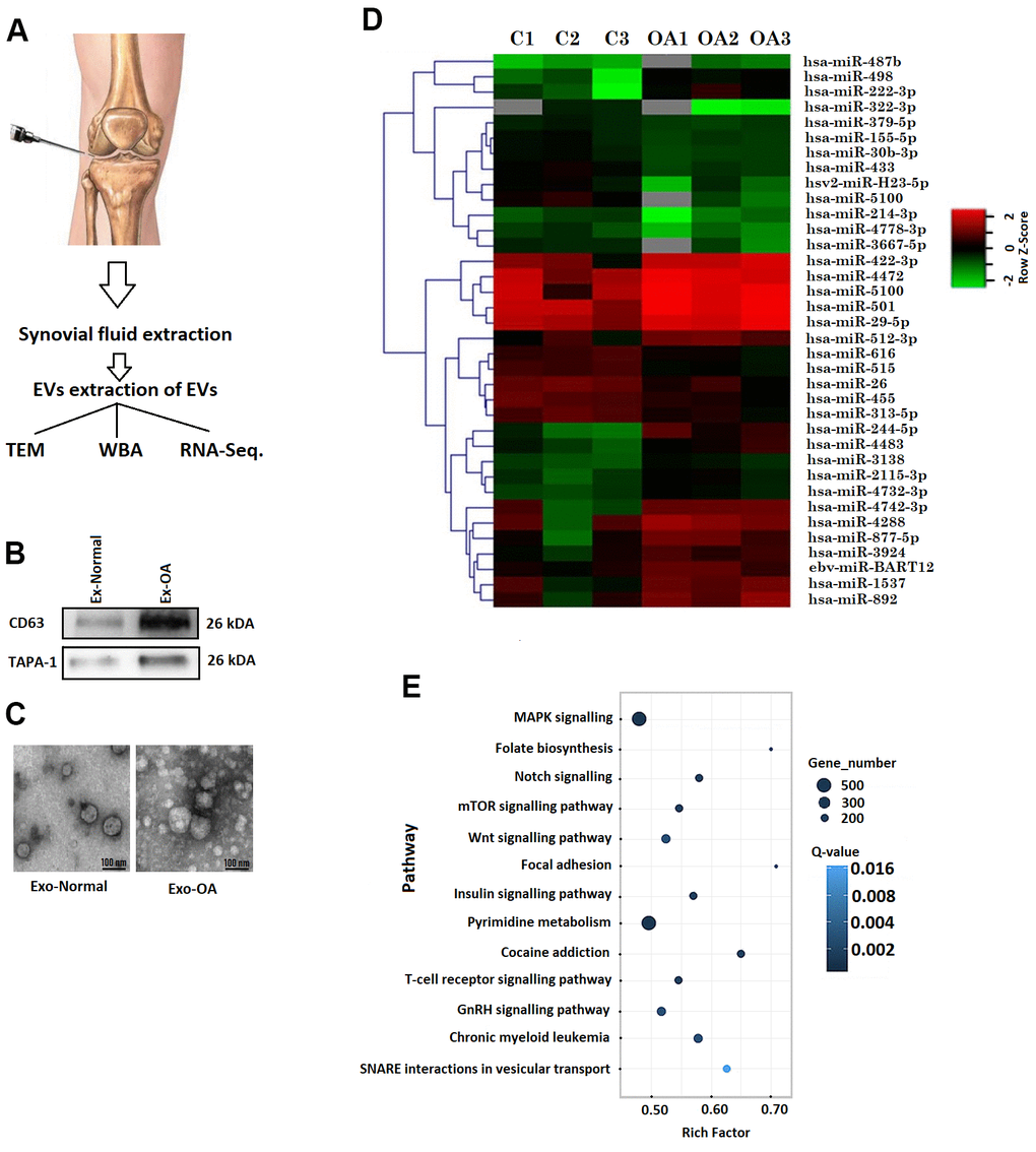 Bioinformatic analysis of exosome encapsulated miRs. (A) Procedure for collecting synovial fluid from knee of human volunteers. (B) Western blot analysis of CD63 and TAPA-1 in exosomes like vesicles. (C) Transmission electron microscopic morphological analysis of exosomes like vesicles. (D) Heatmap showing expression of miRs in synovial fluid exosomes of OA subjects. (E) Annotations of KEGG pathway analysis showing various pathways.