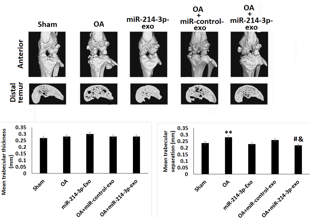 SFB-miR-214-3p exosomes maintained the subchondral bone structure in OA rats. Micro-CT analysis showing bones of rats subjected ACLT+MMX OA. Quantitative analysis showing mean trabecular thickness and mean trabecular separation. The results are presented as mean (n=3) ± %RSD. *P