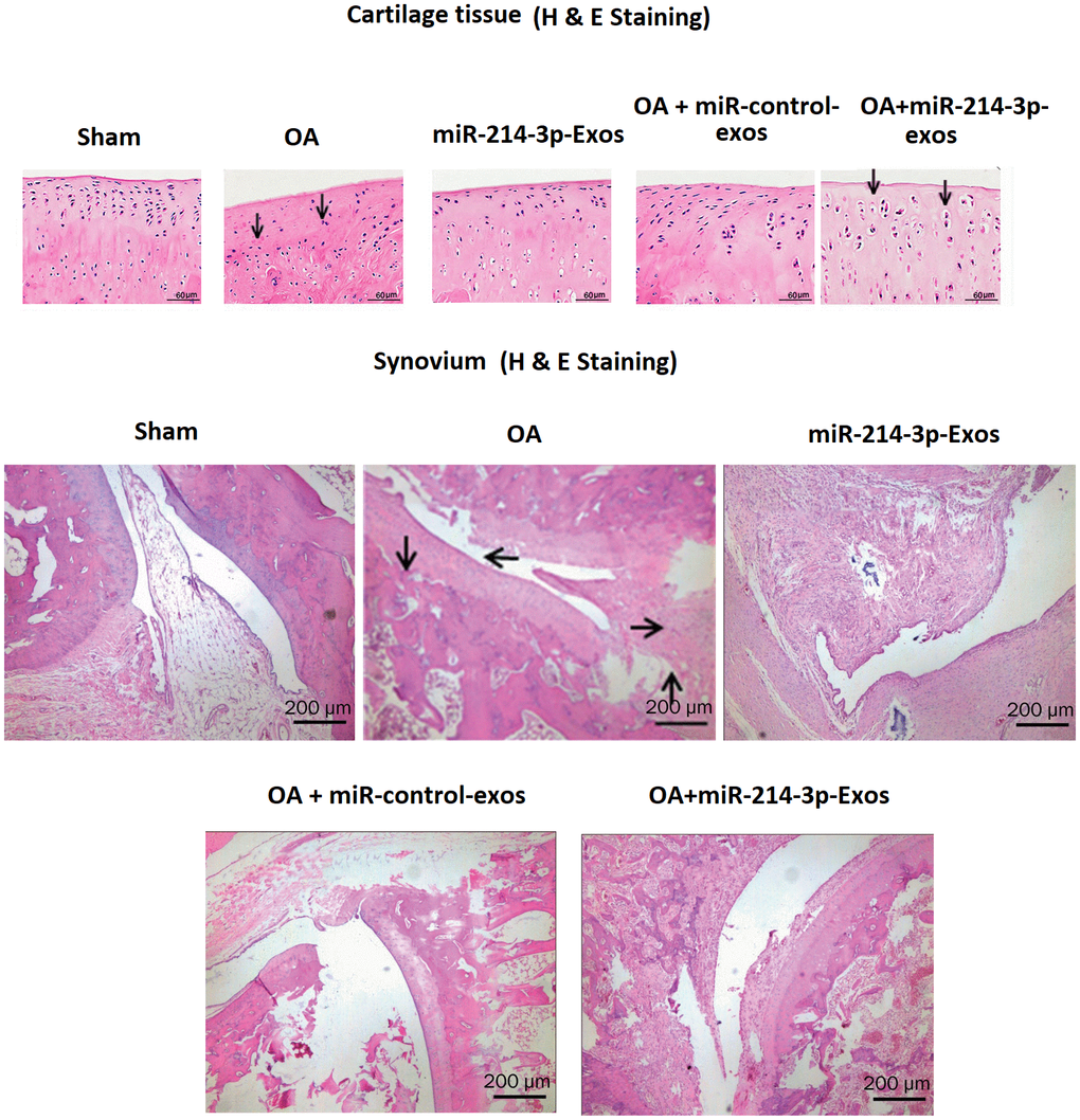 SFB-miR-214-3p exosomes inhibited the synovial inflammation induced degeneration of cartilage and synovium in OA rats. H&E staining of cartilage or synovium of OA rats treated with SFB-miR-214-3p-exo showing improved cartilage thickness and regularity.