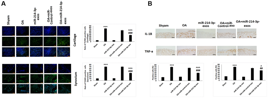 SFB-miR-214-3p exosomes inhibited apoptosis and inflammation in chondrocytes of articular cartilage in OA rats. (A) TUNEL analysis of cartilage and synovium for assessing apoptosis. (B) Immunohistochemical analysis for analysis of IL-1β and TNF-α in cartilage and synovium of OA rats. The results are mean ± %RSD. ***P