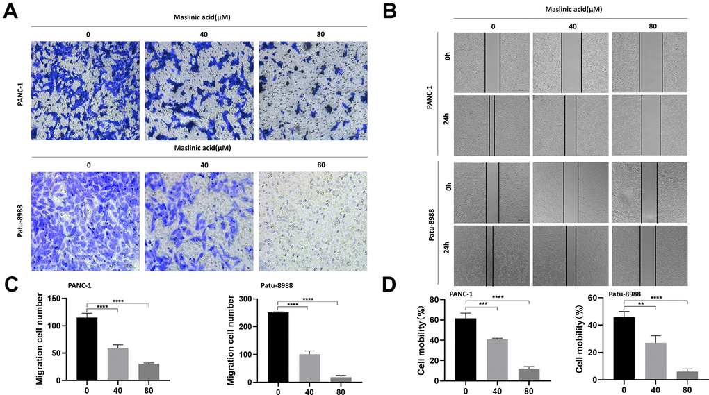 MA-mediated inhibition of the migration of PANC-1 and Patu-8988 cells. (A) Transwell chamber assay analysis of the effect of MA (0, 40, 80 μM) on the migration of PANC-1 and Patu-8988 cells. (B) Wound healing assay analysis of PANC-1 and Patu-8988 cells incubated with MA (0, 40, 80 μM) for 24 h. (C) The quantification results of migration cell number. (D) The quantification results of cell mobility. Data are representative of three independent experiments and expressed as mean ± SD. **p 
