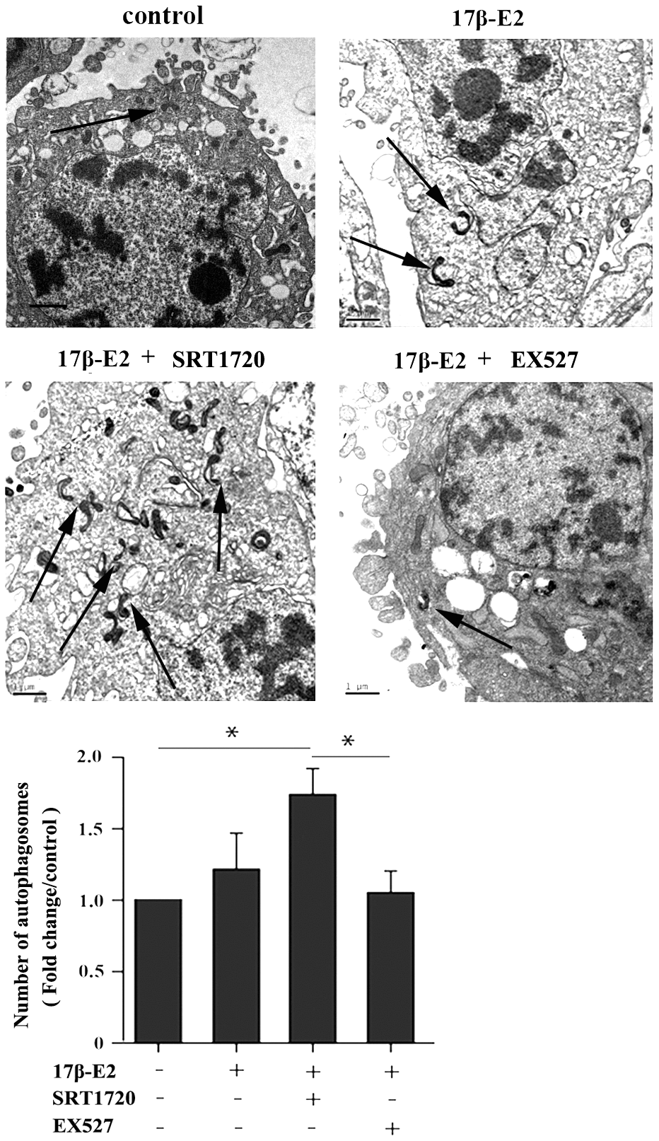 Effect of SIRT1 up-regulation induced by 17β-E2 on cell autophagy in hFOB1.19 osteoblasts. TEM images showed more double-membrane vacuoles (autophagosomes) in cells treated with 17β-E2 + SRT1720 compared with those in the control group and 17β-E2 + EX527 group. The histogram showed the number of autophagosomes in different groups as indicated. The autophagic vacuoles are indicated with black arrows. Black bar: 1 μm. * P 