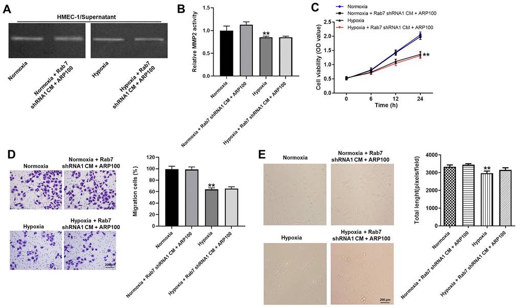 Rab7 shRNA1 reversed hypoxia-induced decrease of migration and angiogenesis in HMEC-1 cells via upregulation of MMP-2 activity. (A, B) The MMP-2 activity in HMEC-1 cells was tested by Gelatin Zymography. (C) The viability of HMEC-1 cells was tested by CCK-8 assay. (D) The migration of HMEC-1 cells was tested by transwell assay. (E) The angiogenesis of HMEC-1 cells was investigating by calculating the total length. **P