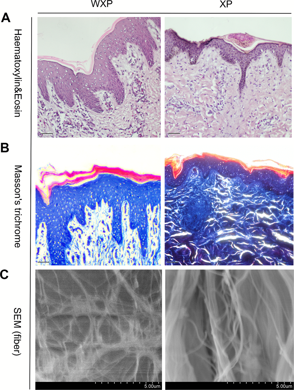 Skin histological features abnormal in Xiang pigs with systemic wrinkle (WXP). Representative Haematoxylin and Eosin and Masson's trichrome-stained skin sections of WXP and XP. And scanning electron microscope to observed the collagen fiber structure of the dermis. Scale bars: 50 μm in (A, B) and 5 μm in (C).