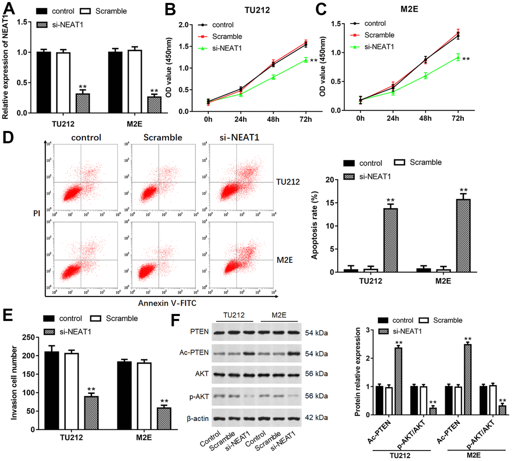 Downregulation of NEAT1 suppressed laryngocarcinoma cell proliferation and invasion. (A) The transfection efficiency was detected after transfection with si-NEAT1 for 24 h in TU212 and M2E cells. (B, C) Cell proliferation of TU212 and M2E cells were detected using CCK-8 assay after transfection with si-NEAT1 for 0, 24, 48 and 72 h. (D) Apoptosis rates of TU212 and M2E cells after transfection with si-NEAT1 were detected using Flow cytometry. (E) Transwell assay was used to evaluate cell invasion ability after transfection with si-NEAT1 for 48 h. (F) Western blot analysis was used to detect the protein expression levels of PTEN, Ac-PTEN, AKT and p-AKT after transfection with si-NEAT1. ** P 
