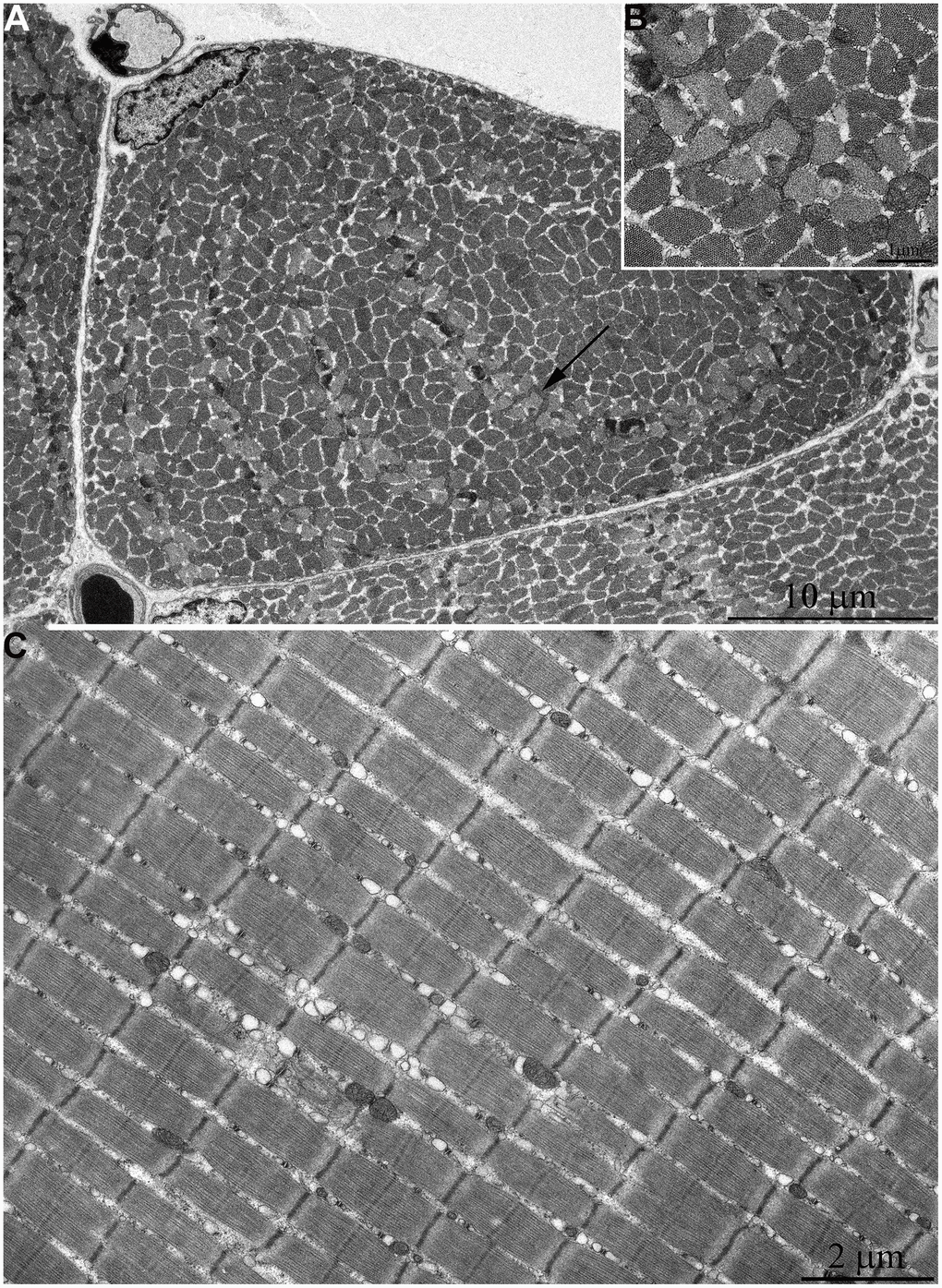 Ultrastructure of mitochondria in skeletal muscle of six-month-old naked mole rat. (A) Cross section of muscle fiber. Small, isolated mitochondria and group of mitochondria, which ultrastructure is demonstrated at higher magnification in (B) is indicated by an arrow. (C) Longitudinal section of muscle fiber. Small, widely spaced mitochondria.