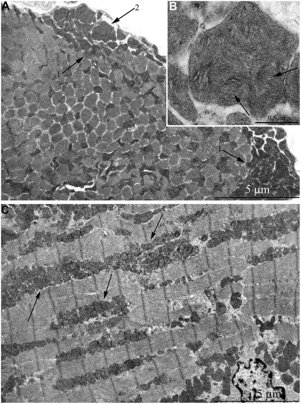 Ultrastructure of mitochondria in skeletal muscle of 7-year-old naked mole rat. (A) Cross section of muscle fiber. Clusters of large mitochondria in the subsarcolemmal area are indicated by arrows 1. Mitochondrion of specific ultrastructure, which is demonstrated in Figure 5B, is indicated by arrow 2. (B) Mitochondrion which specific ultrastructure, cristae in form of curled, wave-like structures are indicated by arrows. (C) Longitudinal section of muscle fiber, large clusters of mitochondria localized along myofibrils are indicated by arrows.