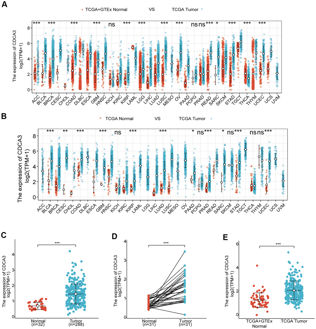 Overexpression of CDCA3 in patients with KIRP. (A) CDCA3 expression in normal samples from the GTEx database and the TCGA and 33 tumor samples in TCGA. ns, p ≥ 0.05; *, p pp B) CDCA3 expression in 33 tumor samples in TCGA and paired paracancerous tissues in TCGA. ns, p ≥ 0.05; *, p p p C) CDCA3 mRNA expression level in 288 KIRP samples and 32 normal samples. *** p D) CDCA3 mRNA expression in KIRP tissues and in paired paracancerous normal samples. *** p E) CDCA3 mRNA expression in normal samples and KIRP from the GTEx database and TCGA. *** p 