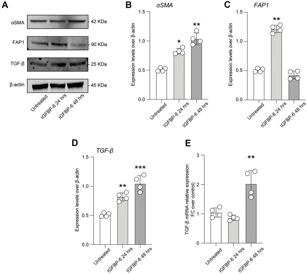 IGFBP-6 induces CAF differentiation in mesenchymal stem cells. (A) HS5 cells exposed to 200 ng/mL of IGFBP-6 for 24h and 48h were lysed and subjected to immunoblotting using specific antibodies against α-SMA, FAP1, and TGF-β. Protein content was normalized to the housekeeping protein β-actin. The entire assay was made in triplicate, a representative one is shown. Signals from immunodetected bands were semi-quantified by densitometry. (B–D) Statistical analysis of data revealed that α-SMA expression was significantly increased in the HS5 cells IGFBP-6- induced for 24h and 48h (B), FAP1 expression was significantly increased in the HS5 cells IGFBP-6- induced for 24h (C) TGF-β expression was significantly increased in the HS5 cells IGFBP-6- induced for 24h and 48h (D). Data are presented as means ± sem. **p E) qPCR results were obtained for TGF-β in HS5 cells exposed to 200 ng/mL of IGFBP-6 for 24h and 48h. Relative mRNA expression level normalized with β-actin by using a comparative 2-ΔΔCt method. **p 