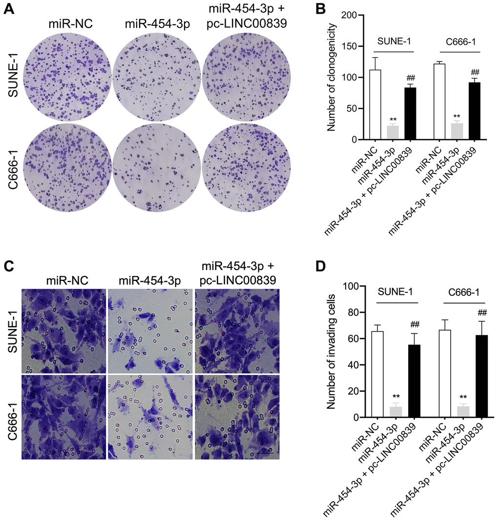 LINC00839 reverses the effects of miR-454-3p in SUNE-1 and C666-1 cells. (A–B) SUNE-1 and C666-1 cells were transfected with miR-454-3p or co-transfected with miR-454-3p and pc-LINC00839. The growth of NPC cells was measured using colony formation assay. (C–D) The invasion of NPC cells was assessed using Transwell assay. **P ##P 