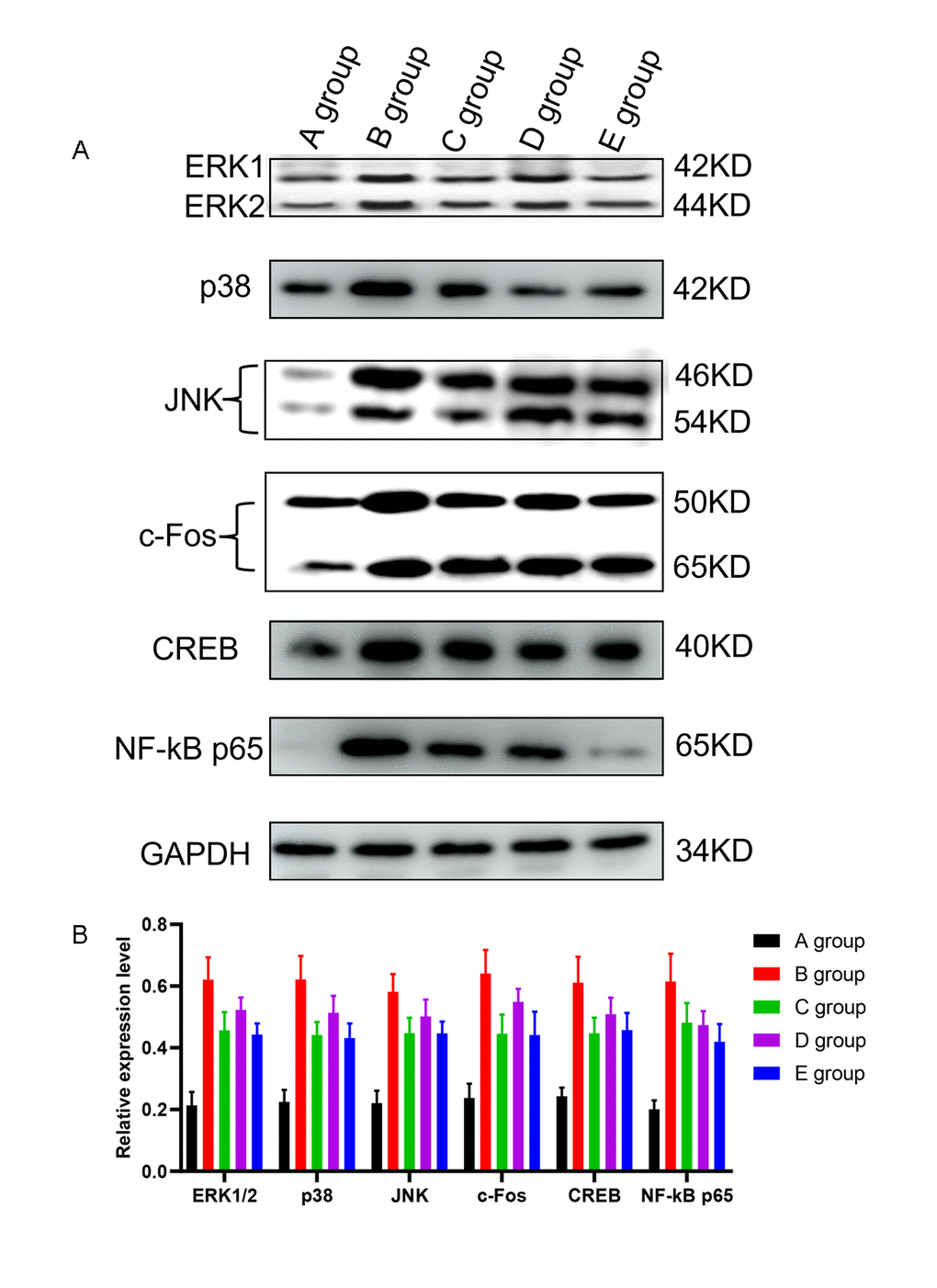 The effect of Huangqi Guizhi Wuwu Decoction on the expression of ERK1/2, p38, JNK, c-Fos, CREB and NF-kB in the L4-L5 dorsal root ganglions of different rat groups detected by western blotting. (A) The expression of ERK1/2, p38, JNK, c-Fos, CREB, NF-kB and GAPDH in different rat groups. (B) The relative expression levels of ERK1/2, p38, JNK, c-Fos, CREB, and NF-kB compared to GAPDH in different rat groups.
