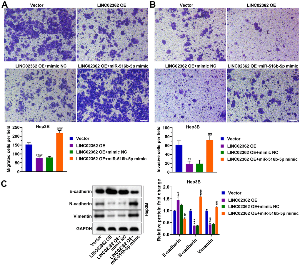 miR-516b-5p is pivotal for the effects of LINC02362 on the migration, invasion and EMT of HCC cells. (A) Transwell assays to test the effects of LINC02362 and miR-516b-5p overexpression on HCC cell migration. Representative images (left) and quantification (right; n=3) are shown. (B) Transwell assays to test the effects of LINC02362 and miR-516b-5p overexpression on HCC cell invasion. Representative images (left) and quantification (right; n=3) are shown. (C) Representative images (left) and quantification (right; n=3) of western blotting analysis for detecting the levels of EMT markers in Hep3B cells. ** or ## 0.001 P P P 