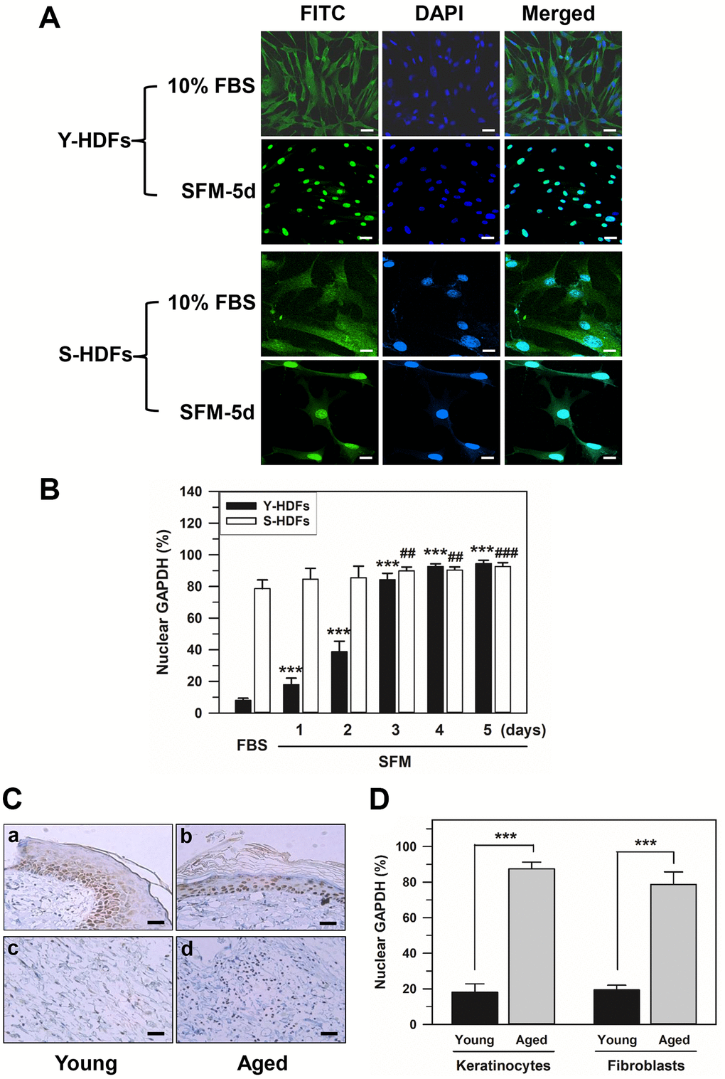 Nuclear accumulation of GAPDH in senescent HDFs. (A and B) Young (Y-HDFs, PD 16) and senescent (S-HDFs, PD 72) cells were maintained in DMEM containing 10% FBS for 2 days and then serum-depleted by incubation with SFM for the indicated times (1–5 days). Cells were immunostained with monoclonal anti-GAPDH antibody and FITC-conjugated anti-mouse secondary antibodies, and analyzed by confocal laser scanning microscopy (magnification, 100×; scale bar, 50 μm). Immunostained young and senescent cells with serum (10% FBS) and without serum for 5 days (SFM-5d) are shown in A. The number of young and senescent HDFs having nuclear GAPDH with or without cytosolic GAPDH was counted, and the percentage distribution was calculated (n = 10 for total replicates) and plotted as means ± standard deviations in B. ***p ##p ###p C) The levels of GAPDH in the back skin cells from young (6 months, a and c) and aged (24 months, b and d) rats were detected by immunohistochemistry and the epithelial layers containing mainly keratinocytes (a and b) and fibroblasts (c and d) were photographed by light microscopy and the ×200 magnified photos with 50 μm scale bar are shown. Each experiment was performed at least three times with similar results. (D) The number of keratinocytes and fibroblasts with nuclear GAPDH was counted in young and aged skin (C), the percentage of cells with nuclear GAPDH was calculated (n = 8 for total replicates) and plotted as means ± standard deviations. ***p 