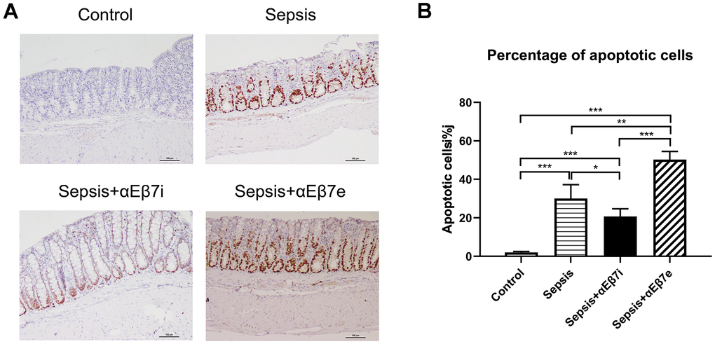 (A) The epithelial cells apoptosis detection of intestinal mucosa in rats of control cohort, sepsis cohort, sepsis+αEβ7i cohort, and sepsis+αEβ7e cohort, respectively. (B) The percentages of apoptotic cells of intestinal mucosa in rats among the four cohorts. * P P P 