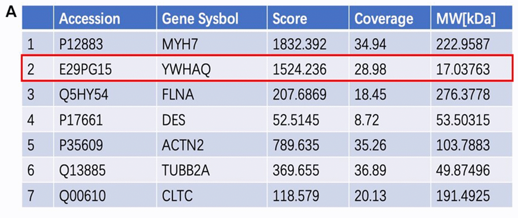 Proteins that interact with SORBS2. (A) The proteins interacting with SORBS2 were screened according to the evaluation score and reliability analysis. We focused on YWHAQ interacting with SORBS2.