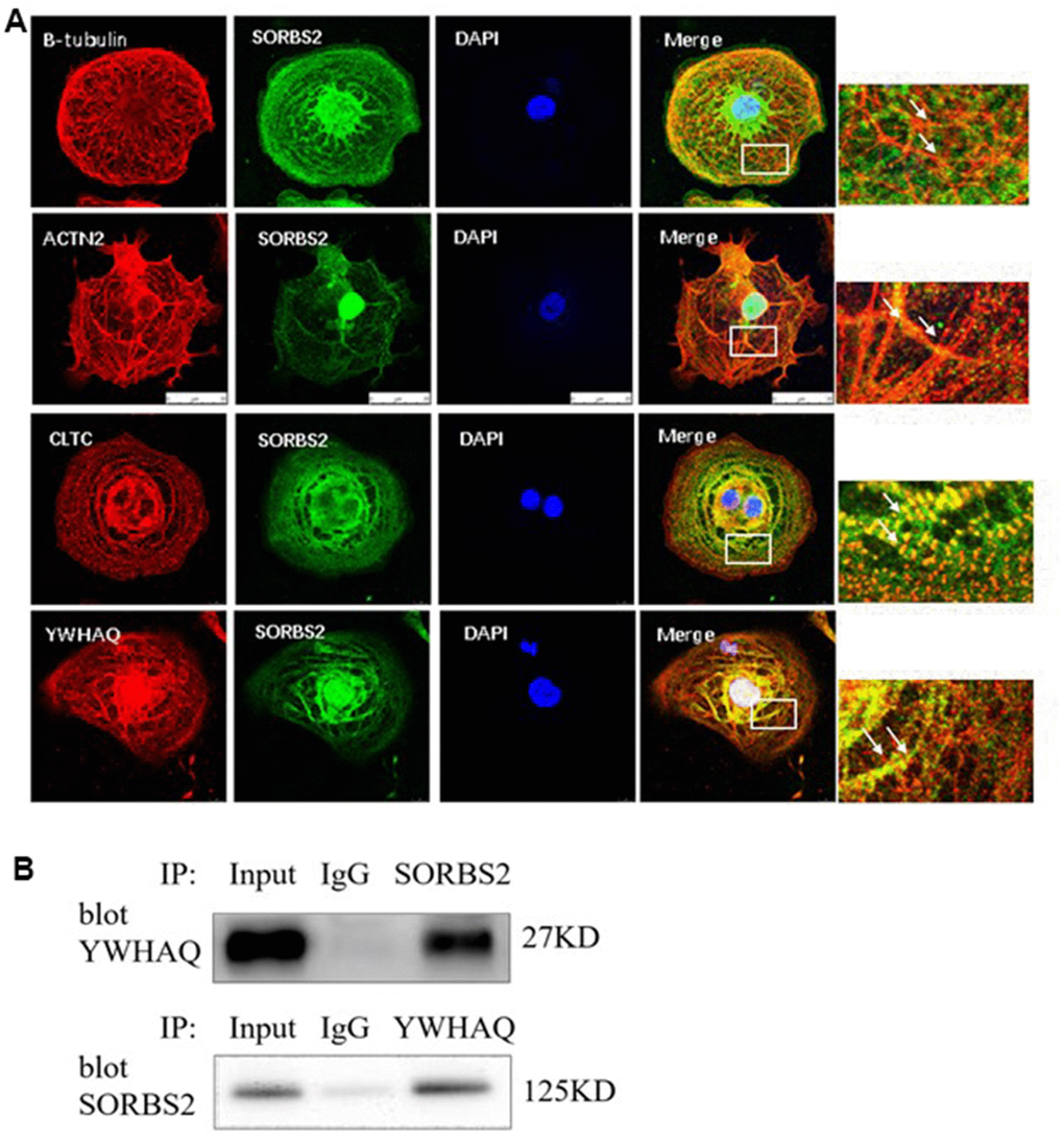 SORBS2 interacts with YWHAQ. (A) To better understand β-tubulin, ACTN2, CLTL and YWHAQ, we next performed studies in hESC-derived cardiomyocytes (hESC-CMs). Immunofluorescence revealed a clear colocalization of SORBS2 with β-tubulin, ACTN2, CLTL and YWHAQ in the hESC-CMs. The SORBS2 protein (red) colocalized with β-tubulin (green), and the merged images are shown in yellow. (B) Extracted proteins from the cardiomyocytes ware untreated (input) or precipitated by an anti-Flag or anti-Myc antibody and then separated by 4-12% SDS-PAGE. Co-immunoprecipitation (Co-IP) of the heart tissue showing SORBS2 binding with YWHAQ.