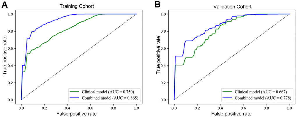 Evaluation of the performance of the radiomics model. The operating characteristic curve analysis of the clinical and radiomics models was plotted in the training set (A) and in the validation set (B). The AUCs of the radiomics model were 0.865 (95% CI: 0.812-0.828) and 0.778 (95% CI: 0.732–0.776) in the training and validation datasets. While the AUCs of the clinical model were 0.750 (95% CI: 0.718–0.734) and 0.667 (95% CI: 0.665–0.724), respectively.