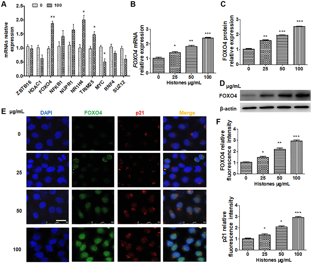 FOXO4 is a downstream target of histone-regulated senescence and inflammation in VSMCs. (A) VSMCs were treated with or without histones (100 μg/mL), and RT-qPCR was performed to determine candidate gene expression. (B–D) VSMCs were treated with various concentrations of histones, and FOXO4 mRNA expression was determined using RT-qPCR (B) or western blotting (C and D). (E) VSMCs were treated with various concentrations of histones, and double immunofluorescence staining was performed to determine FOXO4 and p21 expressions. (F) Quantitative analysis of the fluorescence intensity of FOXO4 and p21 from (E). For (A, B, C, and F), data are from three independent experiments; mean ± SEM; Student's t-test, *P **P ***P 