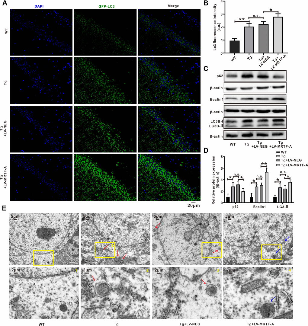 MRTF-A rescued autophagy deficit in Tg2576 mice. (A–D) Immunofluorescence staining and quantitative analysis for LC3B (A, B); simultaneously western blot and quantitative analysis for Beclin1 and SQSTM1/p62 protein expressions (C, D). Data represent means ± SEM from 3 mice per group, *P P P E) Representative transmission electron microscopic images in the hippocampus. Red arrows depict autophagolysosoms and blue arrows depict autolysosomes.