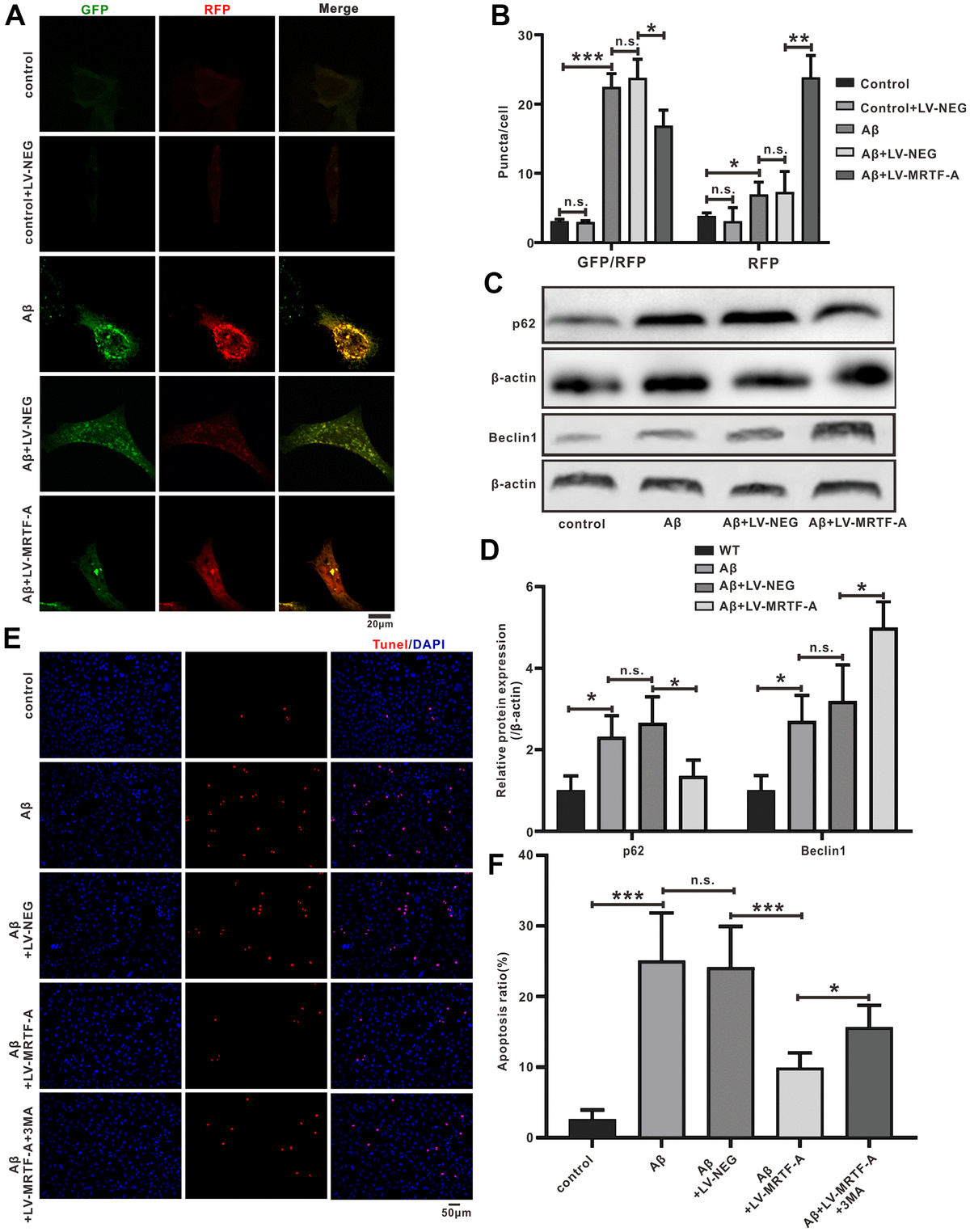 MRTF-A-mediated protection against amyloid-β-induced neuronal injury ...