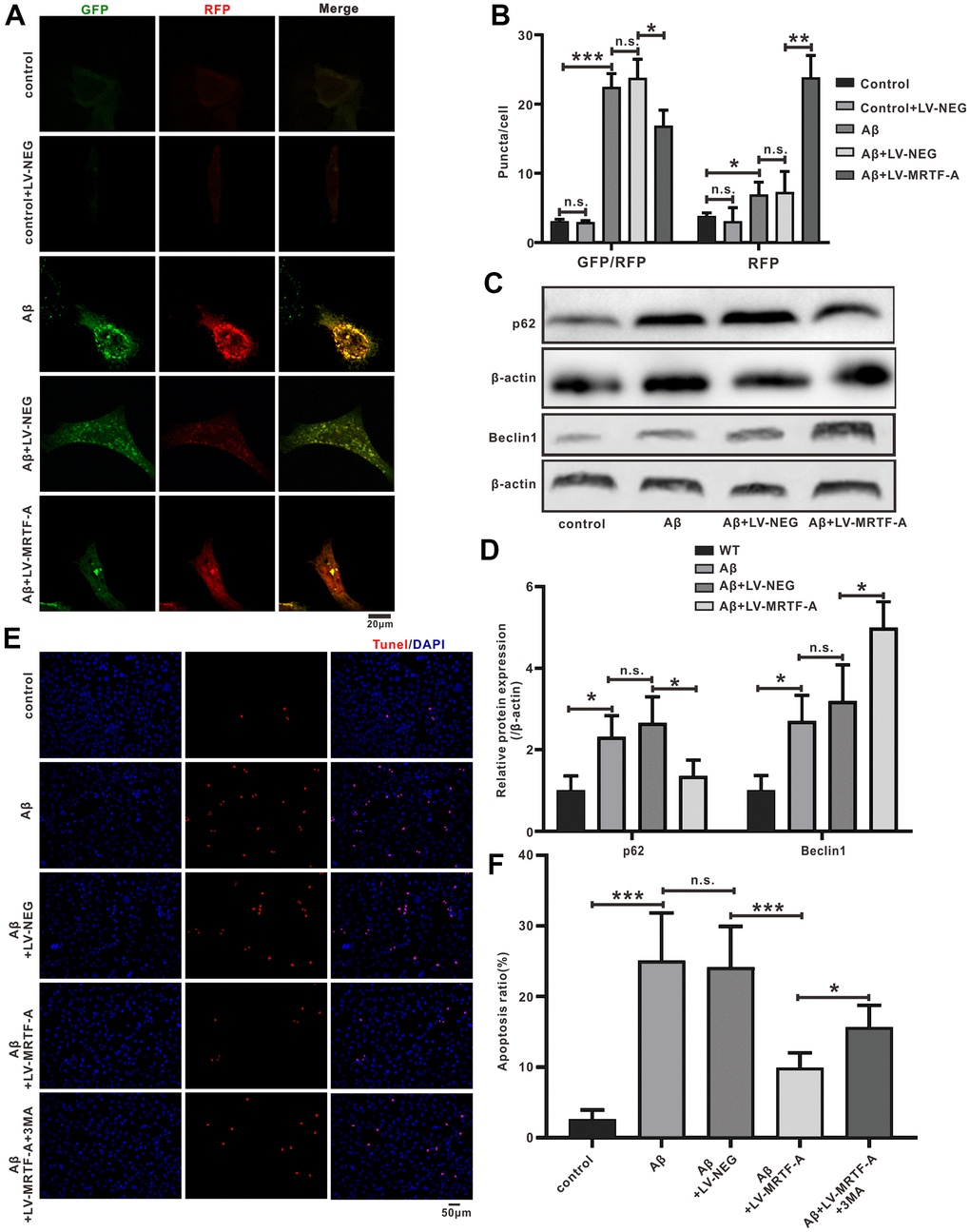 MRTF-A attenuated Aβ-induced neurotoxicity by promoting autophagy in SH-SY5Y cells. (A, B) The autophagy flux analysis using Ad-mCherry-GFP-LC3B-tagged protein. (C, D) Western blot analysis protein for Beclin1 and p62 expression. (E, F) TUNEL staining for cell apoptosis in Aβ-treated SH-SY5Y cells followed MRTF-A treatment co-incubation with or without 3-MA. Data represent means ± SEM of 3 independent experiments. *P P P 