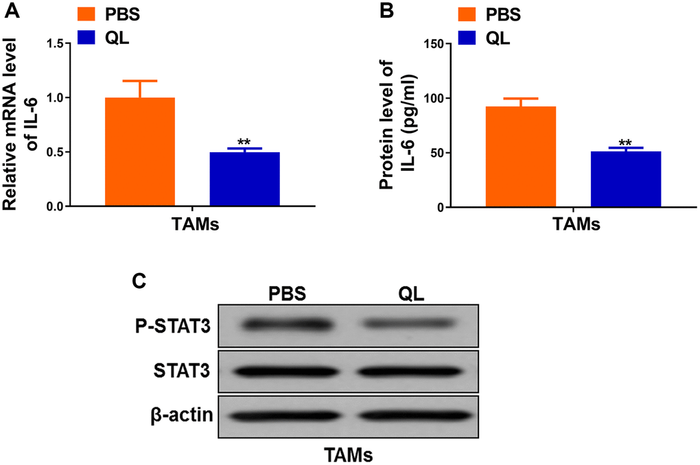 Qi Ling serum suppressed IL-6/STAT3 signaling in TAMs. (A) mRNA level of IL-6 in TAMs treated with Qi Ling or PBS were determined by qRT-PCR. (B) Protein level of IL-6 in TAMs treated with Qi Ling or PBS were measured by ELISA. (C) Total STAT3 and p-STAT3 protein levels TAMs treated with Qi Ling or PBS were determined by Western blot. The data represent the mean ± SD. **p t-test.