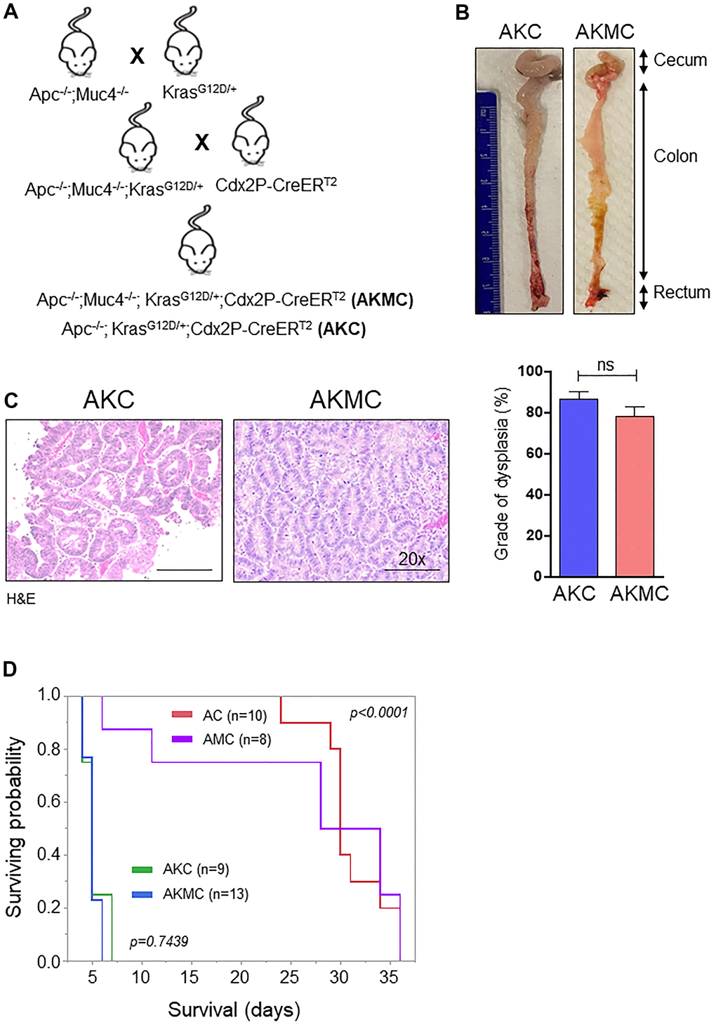 Additional Kras mutation aggravates Apc tumors and reduces survival. (A) Breeding strategy for generation of genetically engineered mice model for Muc4-/- by crossing with Apcflox/flox and KrasG12D mutant mice. First-generation of Apc-/-;Muc4-/-;KrasG12D/+ animals were further crossed with inducible colon specific Cre (Cdx2P-Cre ERT2) mice to get final cross (Apc-/-;Muc4-/-; KrasG12D/+;Cdx2P-CreERT2, AKMC) and its littermate controls (Apc-/-;KrasG12D/+;Cdx2P-CreERT2, AKC). (B) Representative images of the colon in AKC and AKMC animals. (C) H&E images showed a grade of dysplasia in AKC and AKMC mice. n = 3 for AKC and n=6 for AKMC group. (D) Overall survival curves of different mouse models used in the present study. ns = non-significant.