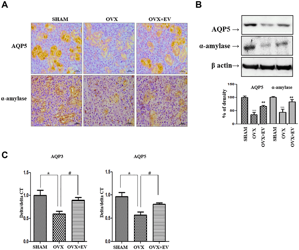 Increased salivary gland function by injected T-MSCs-derived extracellular vesicles. The AQP5- and α-amylase-positive areas significantly decreased in the OVX groups compared with those in the SHAM group. However, AQP5 and α-amylase expression increased in the OVX+EV treatment group (A and B). The mRNA expression of AQP3 and AQP5 decreased in the OVX group and increased mRNA expression of AQP3 and AQP5 in the OVX+EV treatment group, compared with that in the SHAM group (C). One-way ANOVA test; and *p ***p #p ##p 