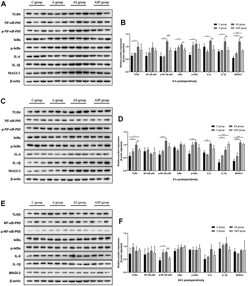 Expression of hippocampal proteins of POD model in aged mice. Six hour postoperatively (A, B) Compared with the C group, TLR4, p-NF-κB p65, IκBα, p-IκBα, IL-6, IL-1β, and MAGI-2 expression was elevated in the AS group. MAGI-2 expression was higher in the ASP group than in the C group. p-NF-κB p65, IκBα, IL-6, IL-1β and MAGI-2 expression was lower in the ASP group than in the AS group. Compared with the C group, *p**p***p#p##pC, D) Compared with the C group, the expression of TLR4, p-NF-κB p65, p-IκBα, IL-6, IL-1β, and MAGI-2 was elevated in the AS group, and the expression of TLR4, IL-1β and MAGI-2 in the ASP group was higher than that in the C group; compared with the AS group, the expression of TLR4 in the ASP group was decreased (Figure 8). Compared with the C group, *p**p***p#p##pE, F) Compared with the C group, p-NF-κB p65 expression was elevated in the AS group, and the p-NF-κB p65 expression was lower in the ASP group than in the AS group. Compared with the C group, *p**p***p#p##p