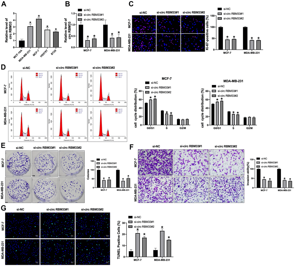 The expression of circRBM33 is upregulated in breast cancer cells. (A) The expression of circRBM33 was analyzed by qPCR in different breast cancer cells. (B–G) The MCF-7 and MDA-MB-231 cells were treated with circRBM33 siRNAs. (B) qRT-PCR was performed to assess the circRBM33 level. (C) Ki-67 staining was used to detect the cell proliferation (D) Cell cycle determined by flow cytometry analysis. (E) The cell proliferation was detected by clone formation assay. (F) The cell invasion was measured by Transwell assay. (G) The cell apoptosis was determined by TUNEL assay. Data are presented as mean ± SEM. Statistic significant differences were indicated: * P P 