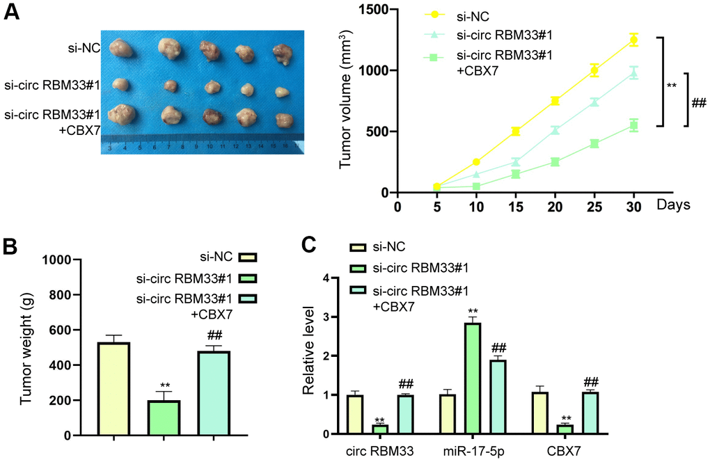 CIRCRBM33 regulates the tumor growth in vivo. (A–C) The SCID nude mice were randomly divided into two groups, then MCF7 cells (1×106/100μL/mouse) transfected with si-control (si-NC) si-circRBM33, or co-transfected with si-circRBM33 and CBX7 overexpressing plasmid were hypodermically injected in the nude mice. The width and length of tumor, and the body weight of mice were measured at indicated time. Tumor volume was calculated by the formula: width (mm)2 × length (mm)/2. The mice were anesthetized to death when tumor size reached 1000 mm3, and the tumors were collected. (A) The tumor volume was shown. (B) The tumor weight was shown. (C) The expression of PITPNA-AS1, miR-17a-5p, CBX7 was determined. N=5. Data are presented as mean ± SEM. Statistic significant differences were indicated: ** P P 