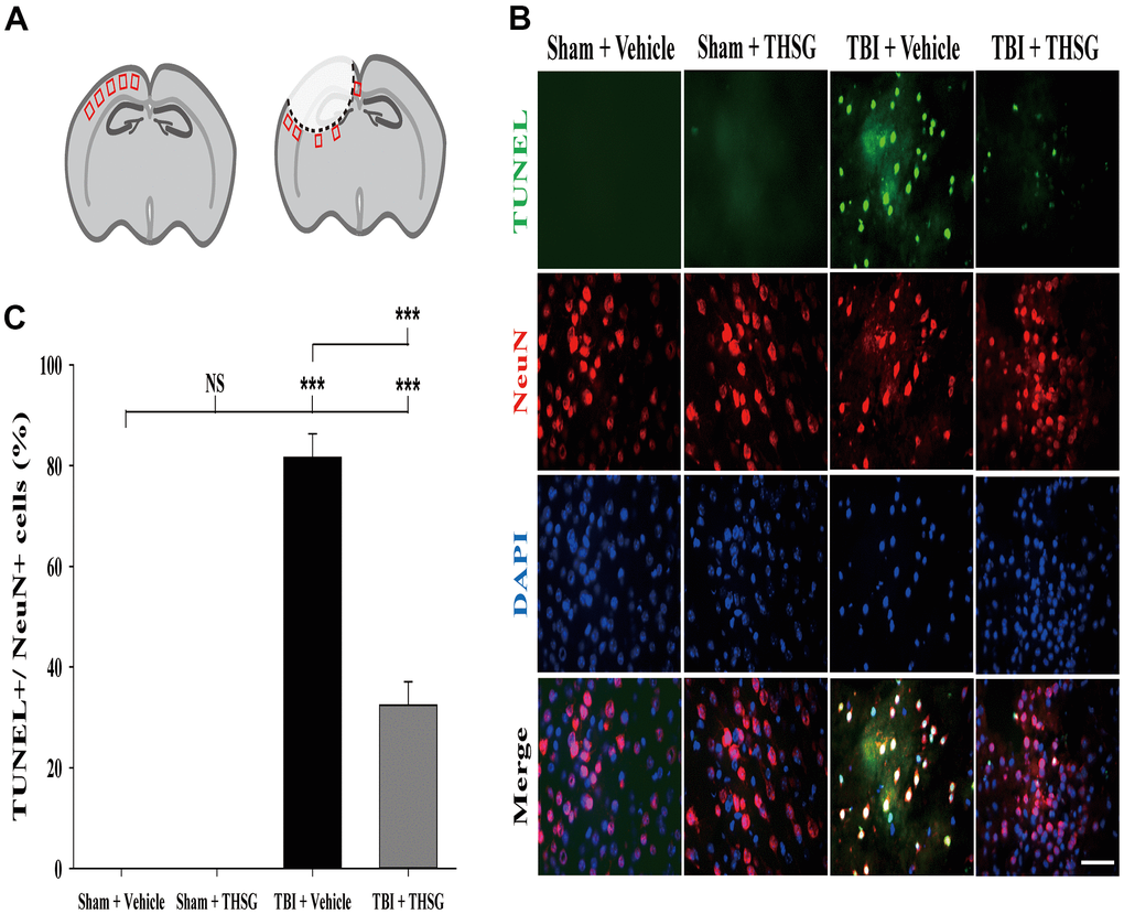 Administration of THSG decreased TBI-induced neural apoptosis in the brain cortex post TBI. (A) Schematic illustration of regions of interest (ROIs) in cerebral cortex with sham (left) or TBI (right). The sampling areas are shown in red squares. (B) Representative double staining immunofluorescence with TUNEL assay (green) and NeuN (a maker for neurons, red) and DAPI (blue) counterstain in brain cortex from the Sham + vehicle, Sham + THSG, TBI + vehicle, and TBI + THSG group. Labeling co-localization is shown as yellow in the merged images. Scale bar = 50 μm. (C) Quantification of the co-localization of the TUNEL positive and NeuN, as well as the counterstaining with DAPI in cortical brain tissues from the Sham + vehicle, TBI + vehicle, and TBI + THSG groups. Data are expressed as the mean ± SEM (n = 6 per group). ***, P 