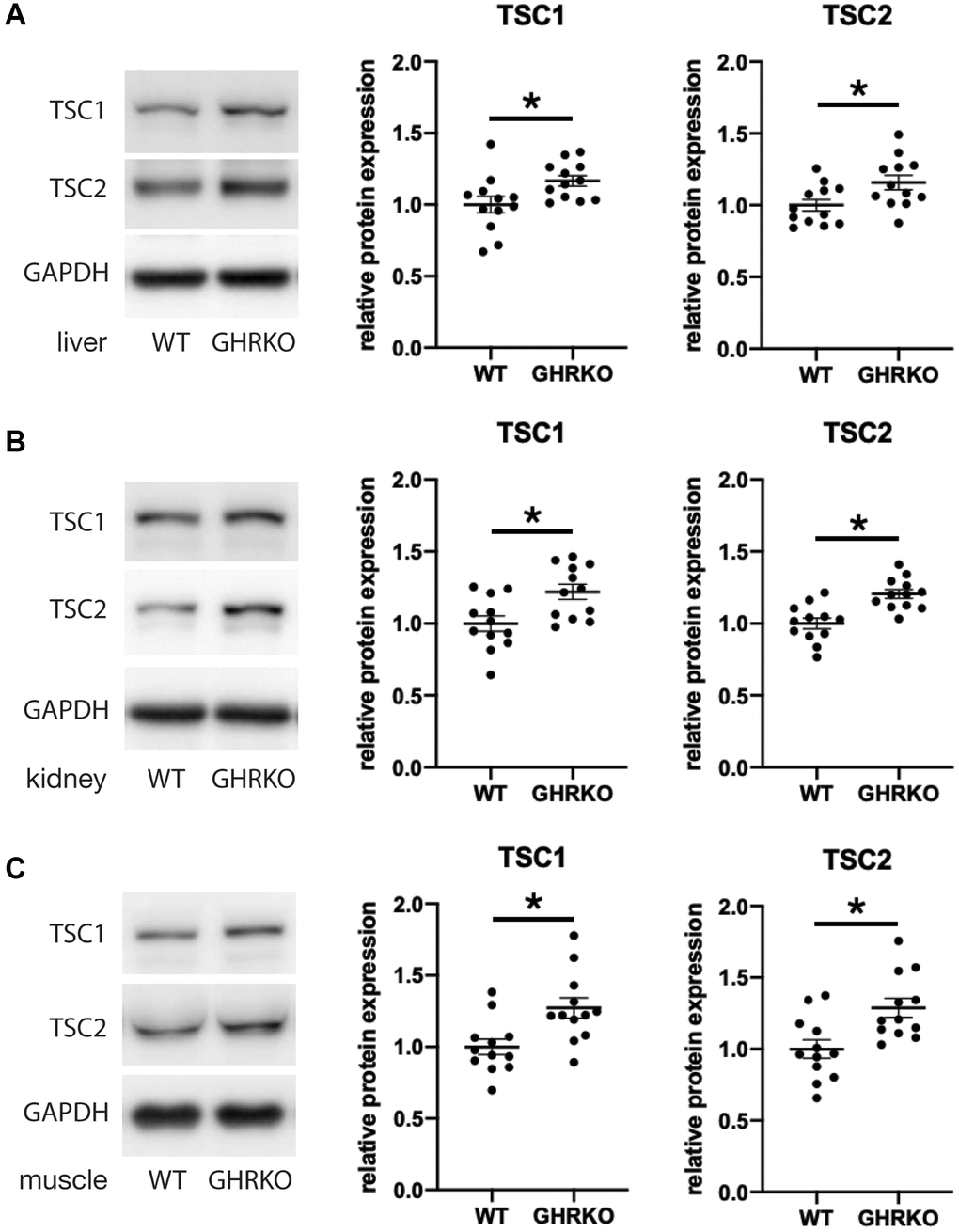 TSC1 and TSC2 are increased in GHRKO tissues. TSC1 and TSC2 protein expression in GHRKO liver (A), kidney (B), and muscle (C). N = 6 male and N = 6 female mice. *t-test p 