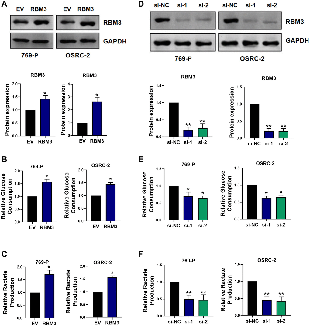 RBM3 facilitated aerobic glycolysis in ccRCC cells. (A) Protein levels of RBM3 was analyzed using western blot in 769-P and OSRC-2 cells. EV indicated the empty vector control; RBM3 indicated the RBM3 overexpression vector. Glucose consumption (B) and lactate production (C) were detected in both 769-P and OSRC-2 cells. n = 6. (D–F) RBM3 protein levels in 769-P and OSRC-2 cells were detected by western blot after transfection with si-RBM3-1 or si-RBM3-2 or negative control. n = 6. *p **p 