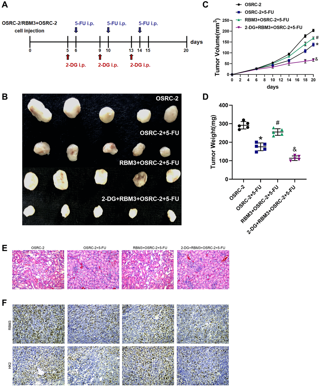 RBM3 dependent on HK2 to regulate the chemoresistance of ccRCC in vivo. (A) Schematic overview of the 5-FU/2-DG treatment and xenograft tumor model. (B) A representative image of RBM3-overexpressing OSRC-2 tumors in nude mice. (C) The volumes of the RBM3-overexpressing OSRC-2 tumors with or without 5-FU treatment. (D) The weights of the RBM3-overexpressing OSRC-2 tumors in nude mice with or without 5-FU treatment. (E) The injury was detected by hematoxylin and eosin staining. (F) The levels of RBM3 and HK2 were analyzed by immunohistochemical staining. n = 5, *p #p &p 