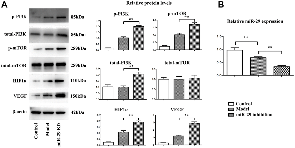 Effect of miR-29 inhibition on the expressions of proteins involved in the PI3K\mTOR\HIF1α\VEGF pathway in vivo. (A) Results showed that the protein expressions of p-PI3K, p-mTOR, HIF-1α, and VEGF were elevated in miR-29 inhibition group compared with those in model group. (B) The relative miR-29 fold change was tested by qPCR, and it was found that the miR-29 level was decreased in model group compared with that in control group, and miR-29 inhibition lentivirus group exhibited the lowest miR-29 level among 3 groups. Data were presented as mean ± SE (**P