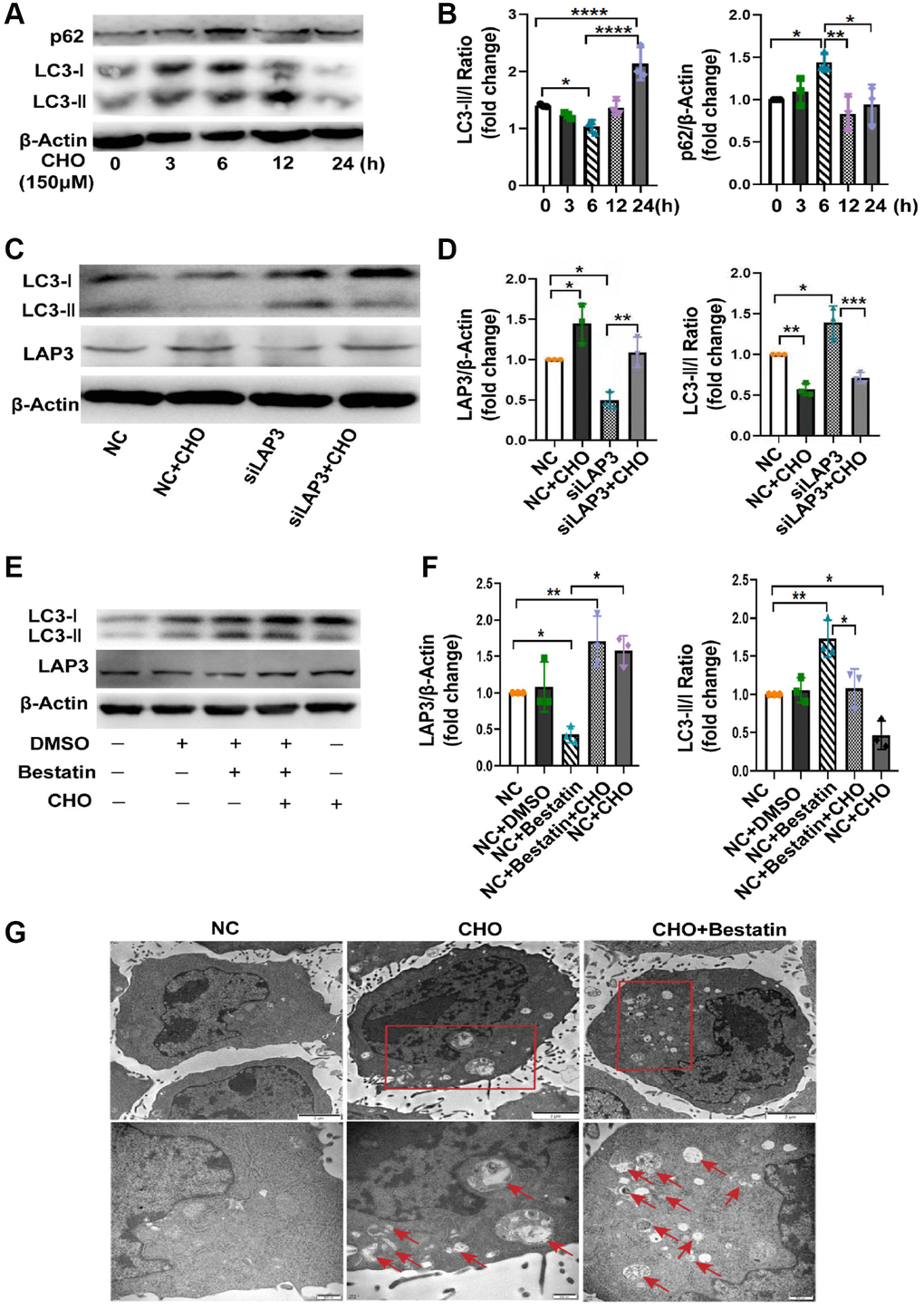Upregulation of LAP3 by cholesterol inhibits autophagy in LO2 cells. (A and B) Representative western blotting detailing autophagic flux in CHO-treated LO2 cells (A) and quantitative analysis (B). (C and D) Evaluation of LAP3 and autophagy marker LC3 II and LC3 I expression after treatment of LO2 cells with 150 μM CHO or siLAP3 at 6 h by western blotting (C) and quantitative analysis (D). (E and F) Evaluation of LAP3 and LC3 II and LC3 I expression after treatment LO2 cell with 150 μM CHO or 14 μM bestatin at 6 h by western blotting (E) and quantitative analysis (F). (G) LO2 cells were treated with 150 μM CHO or 14 μM Bestatin for 6 h, the formation of autophagic vacuoles (→) was examined by transmission electron microscopy analysis. Data are expressed as means ± SD from three independent experiments. *p **p ***p 