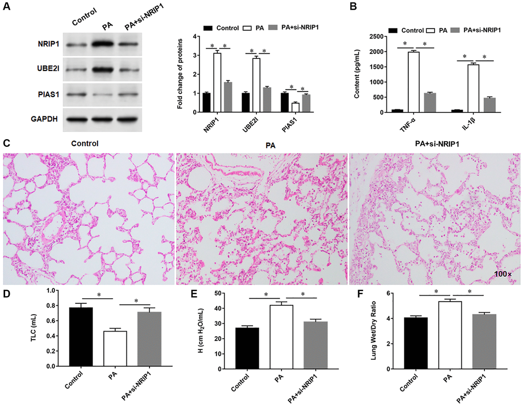 Interference with NRIP1 expression attenuates lung injury in PA infected mice. A total of 18 mice randomly divided into control group (injection of the same volume of 0.9% sterile saline solution as the PA011), PA group (intratracheally instilled with 50 μL of PA011) and si-NRIP1 group (PA treated mice were injected intraperitoneally with 20 nM si-NRIP1 once daily), with six mice in each group. (A) The protein expression of NRIP1, UBE2I and PIAS1 in lung tissues was analyzed by Western botting. (B) Relative content of TNF-α and IL-1β in lung tissues were analyzed by ELISA kits. (C) Representative images of HE staining of lung tissues. (D, E) Total lung capacity (TLC) and tissue elastance (H) were assessed using FlexiWare software. (F) The ratio of lung wet-to-dry weight was calculated. GAPDH was used as an internal reference. *P 