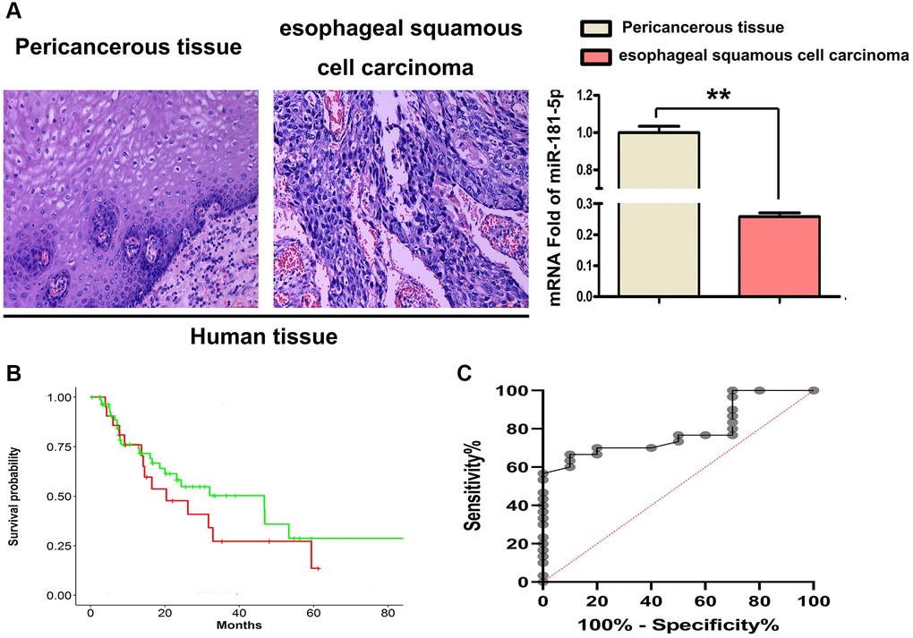 MiR-181a-5p was downregulated in 4 paired human ESCC tissues. (A) H&E staining was used to identified ESCC tissues and their corresponding adjacent peri-cancerous tissue specimens, RT-qPCR of miR-181a-5p expression in human ESCC tissues. *P B) Kaplan-Meier's method was used for survival analysis and miR-181 survival curve was drawn. (C) Kaplan-Meier analysis was used to depict the overall survival curves of patients with of ESCC from the data in GSE114110.
