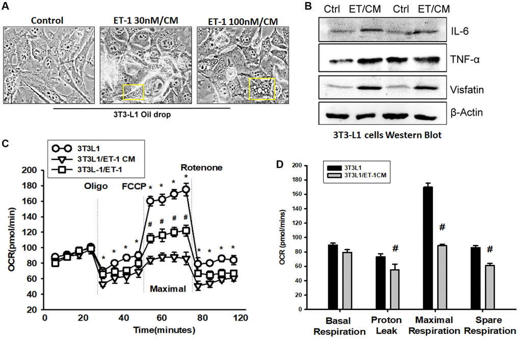 Endothelin-1 (ET-1) enhances IL-6, TNF-α, and visfatin synthesis and reduces mitochondria oxygen consumption in AT. (A) Bright-field image (100×) of 3T3-L1 preadipocytes cells were incubated with supernatant from C2C12 and observes for 3days with oil-drop. (B) Supernatant from C2C12 and G7 treated with ET-1 were incubated with 3T3-L1 cells. in vitro IL-6, TNF-α, and visfatin activity were measured through Western blotting. (C) 3T3L-1 cell mitochondrial energy measured by Seahorse. Representative OCR plot with the injection of oligomycin, FCCP, and rotenone. (D) Quantization data of the different areas of ORC. All the control groups in Figure 7 are from the control CM of C2C12 without treat with ET-1. Results are expressed of four independent experiments performed in triplicate. *p #p 