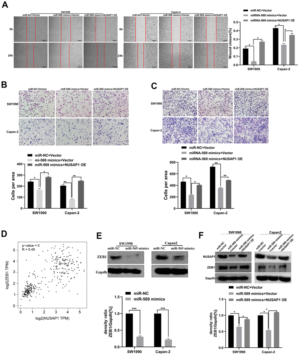 miR-569/NUSAP1/ZEB1 axis involved in the metastasis of PC cells. (A) Wound healing showed the migratory abilities of PC cells transfected with a combination of miR-NC and vector, or miR-569 mimics and vector, or miR-569 mimics and NUSAP1 OE; (B) Transwell assay showed the migratory abilities of PC cells transfected with a combination of miR-NC and vector, or miR-569 mimics and vector or miR-569 mimics and NUSAP1 OE; (C) Transwell assay demonstrated the invasive abilities of PC cells transfected with a combination of miR-NC and vector, or miR-569 mimics and vector or miR-569 mimics and NUSAP1 OE; (D) The GEPIA database showed that a significant positive correlation between NUSAP1 and ZEB1 could be observed in PC tissues. (E) Western blot assay showed the ZEB1 protein expression level after over-expression of miR-569. (F) Western blot assay showed the protein expression levels of PC cells transfected with a combination of miR-NC and vector, or miR-569 mimics and vector or miR-569 mimics and NUSAP1 OE; (* p  0.05, ** p  0.01, n = 5, Student’s t-test, means ± 95% CI).