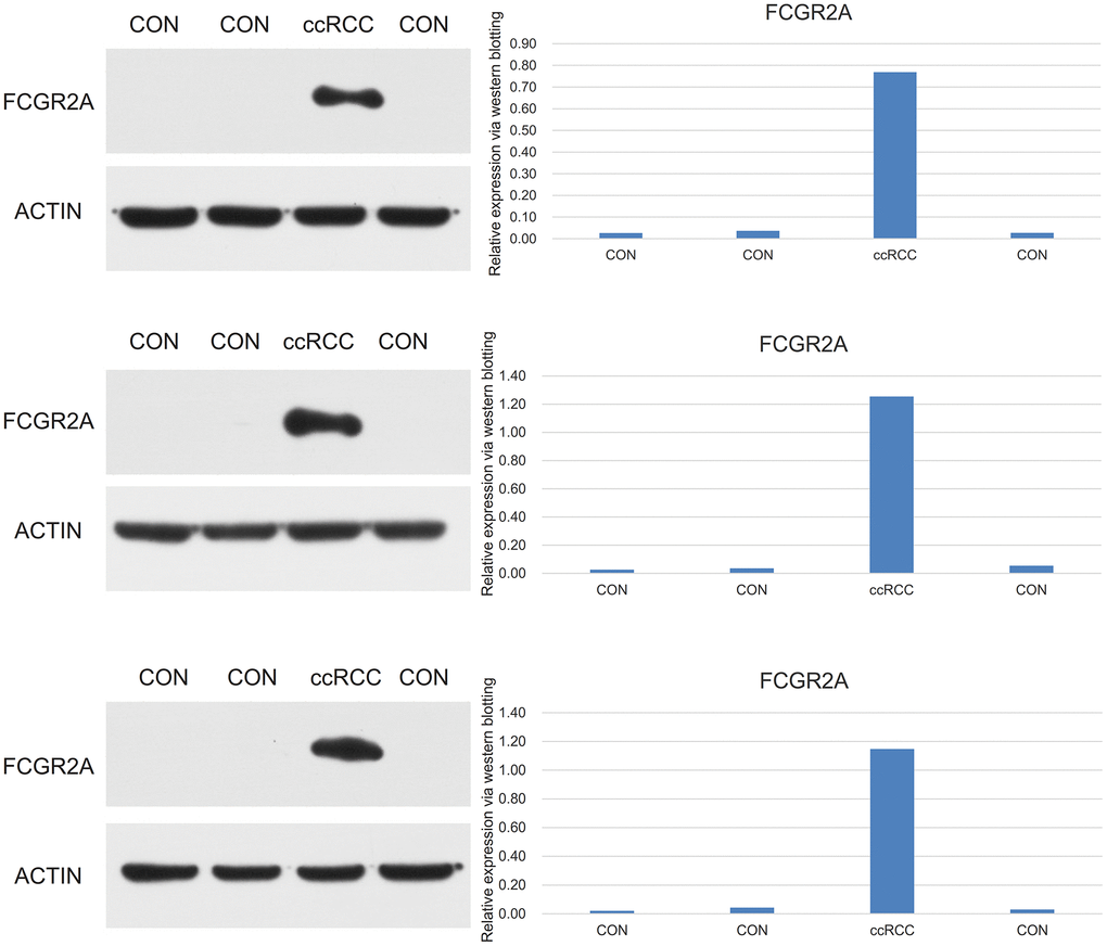 Lower protein expression of FCGR2A in the ccRCC compared with control sample via western blotting.