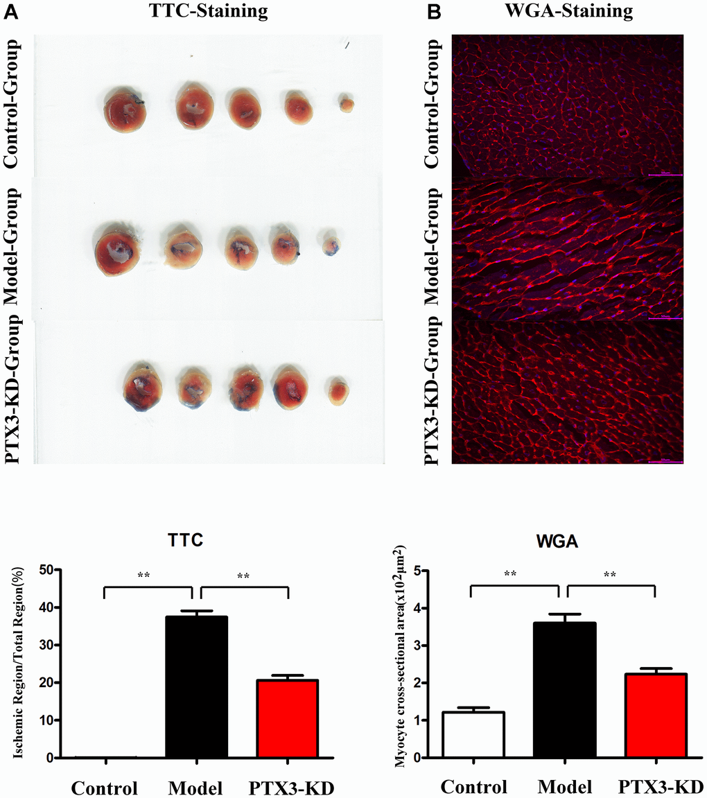 PTX3 KD decreased infarcted areas as well as myocardial hypertrophy in MI of mice. (A) TTC staining images in each group, PTX3 KD decreased infarcted areas of heart after MI. (B) Representative WGA staining in each group, PTX3 KD inhibited the degree of myocardial hypertrophy in mice of MI. *ppp