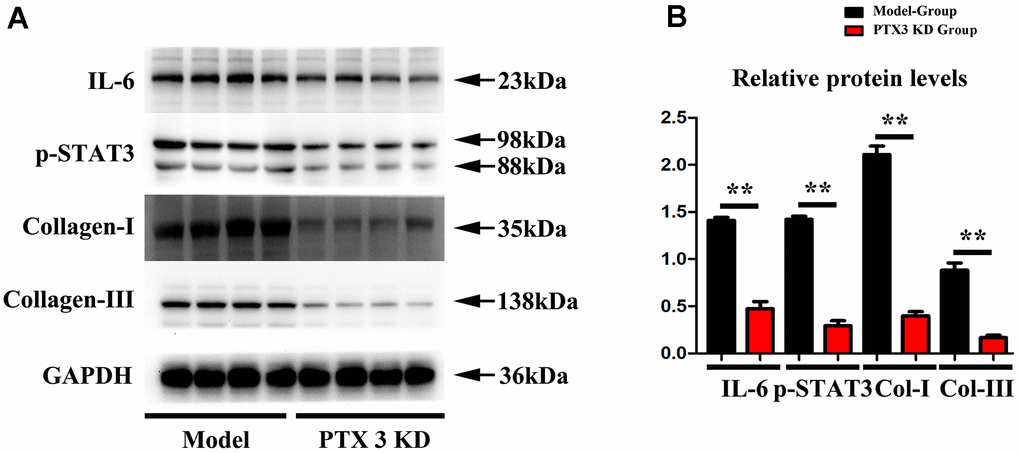 PTX3 KD successfully suppressed the expression of IL-6/STAT3 signals in MI. (A, B) Western blotting was performed to measure the IL-6 and p-STAT as well as fibrosis-associated proteins collagen-I/III expression. Control group vs. PTX3-NC group, *ppp#p##p###p