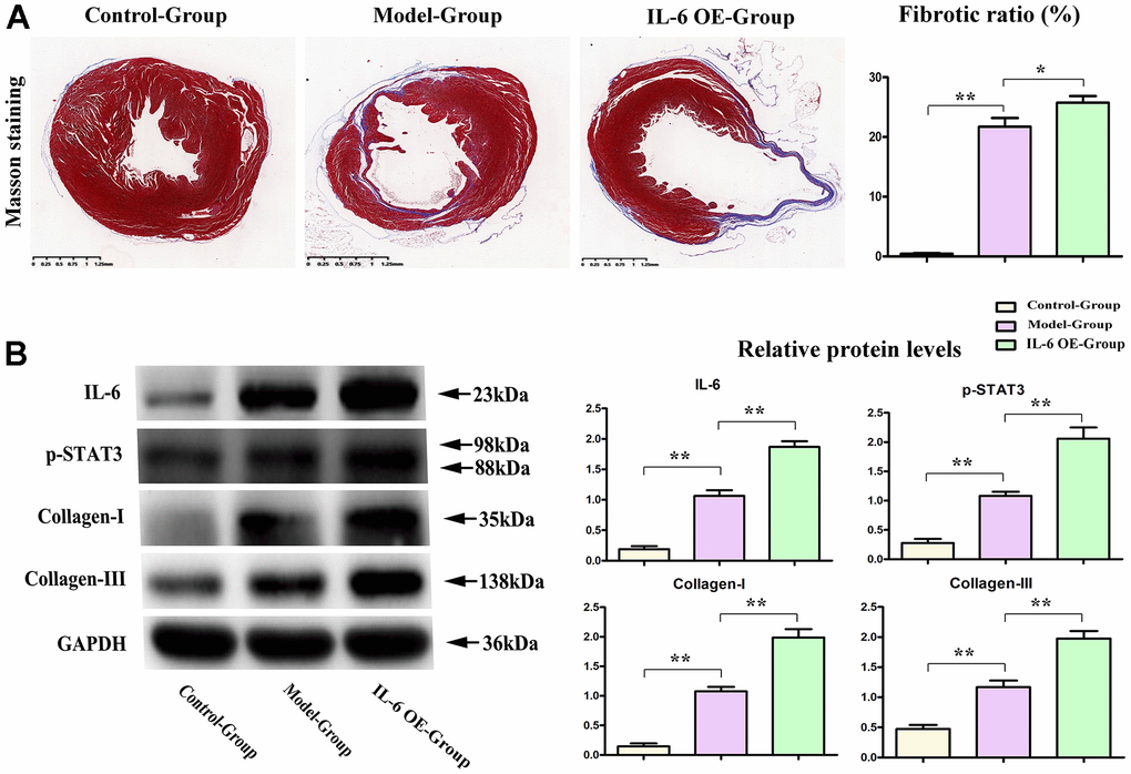 IL-6 STAT3 signal pathway positively accelerated the fibrotic progression of MI. (A) IL-6 OE significantly increased the fibrotic areas in MI vs model group. (B) Western blot results showed the obvious increased expression of IL-6, p-STAT3, and collagen I/III in IL-6 OE group mice vs Model group mice. *ppp