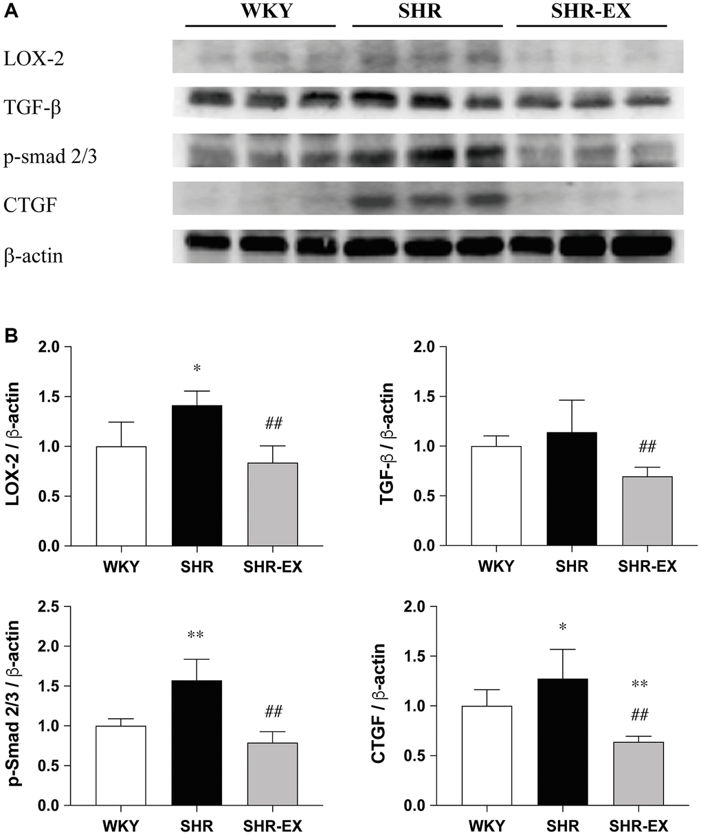 Effects of exercise training on the cardiac fibrotic upstream pathway. (A) The representative protein quantification of LOX-2, TGF-β, CTGF and p-Smad2/3 extracted from the left ventricles were measured by Western blotting analysis; (B) Bars represent the densitometric analysis of LOX-2, TGF-β, CTGF and p-Smad2/3. Data are expressed as the mean values ± SD (n = 8 in each group). *p **p ##p 