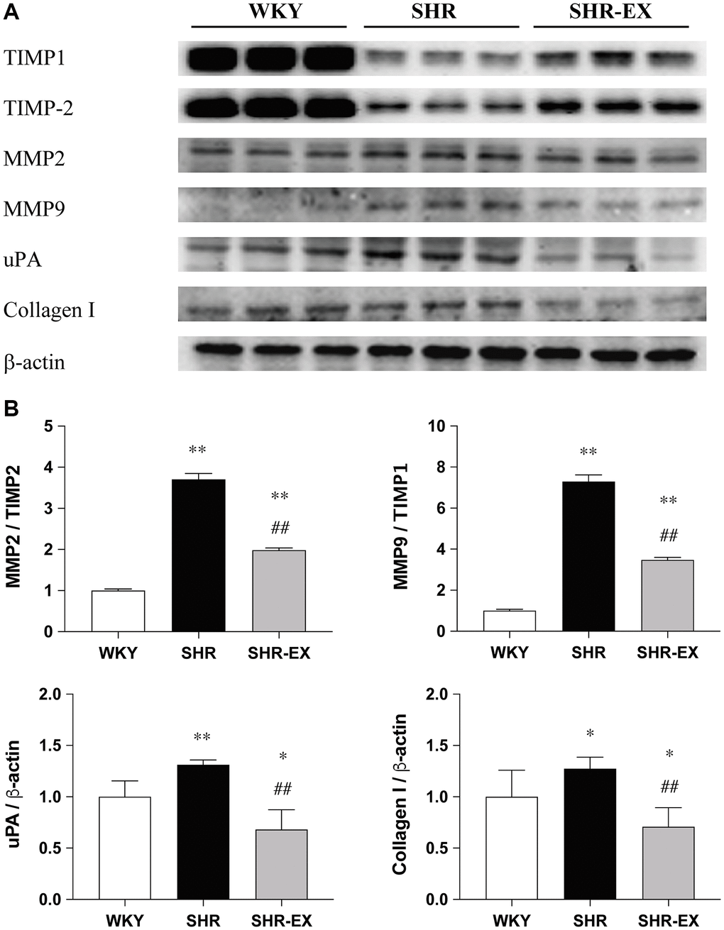 The effects of exercise training on the cardiac fibrotic downstream pathway. (A) The representative protein quantification of TIMP1, TIMP2, MMP2, MMP9, uPA and Collagen I extracted from the left ventricles were measured by Western blotting analysis; (B) Bars represent the densitometric analysis of MMP2/TIMP2, MMP9/TIMP1, uPA and Collagen I. Data are expressed as the mean values ± SD (n = 8 in each group). *p **p ##p 