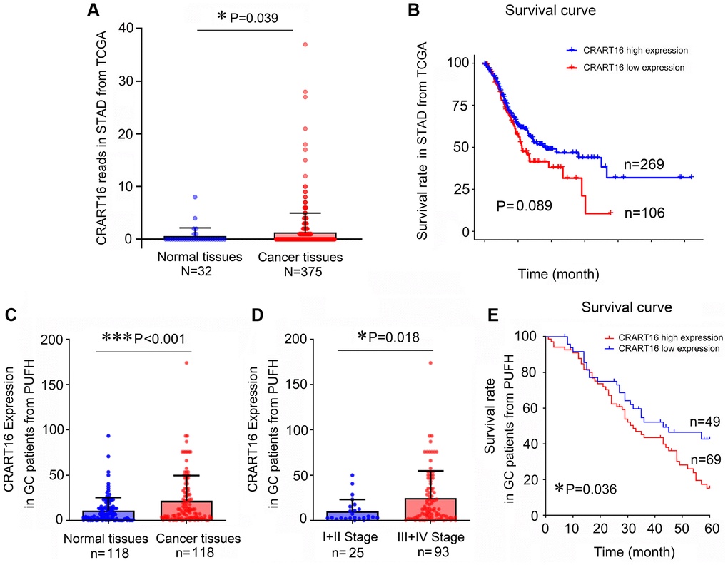 Gastric cancer tissues express a higher level of CRART16, and the higher level of CRART16 correlates with lower overall survival of gastric cancer patients. (A) CRART16 expression levels in normal and cancerous tissues from the TCGA-STAD dataset (*P = 0.039). (B) Survival curves of patients with gastric cancer from TCGA-STAD dataset based on their CRART16 expression level (P = 0.089). (C) Compared with normal gastric tissues, cancerous tissues from our institution expressed a higher level of CRART16 (***P D) Cancerous tissues from stage III/IV gastric cancer expressed significantly higher levels of CRART16 than those from stage I/II gastric cancer (*P = 0.018). (E) The survival curves of gastric cancer patients from our institution were based on their CRART16 expression (log-rank test: χ2 = 4.394, *P = 0.036).